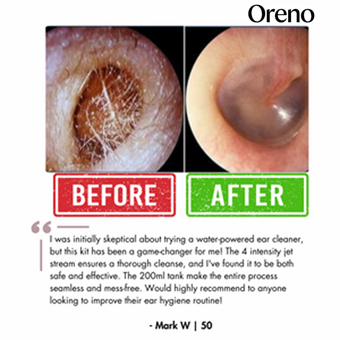 Oreno™ Electric Ear Wax Removal Kit